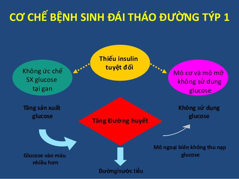 Đái tháo đường type 1