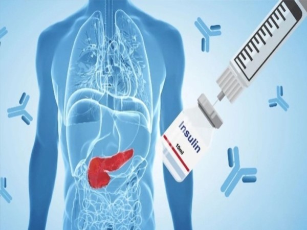 Tiểu đường phụ thuộc insulin là gì?