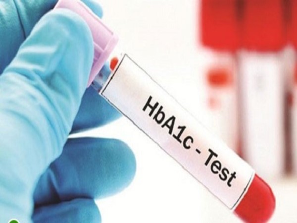 Những xét nghiệm quan trọng giúp kiểm soát biến chứng tiểu đường