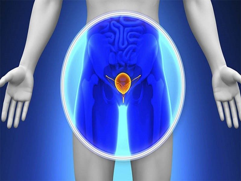 Ung thư tiền liệt tuyến giai đoạn cuối