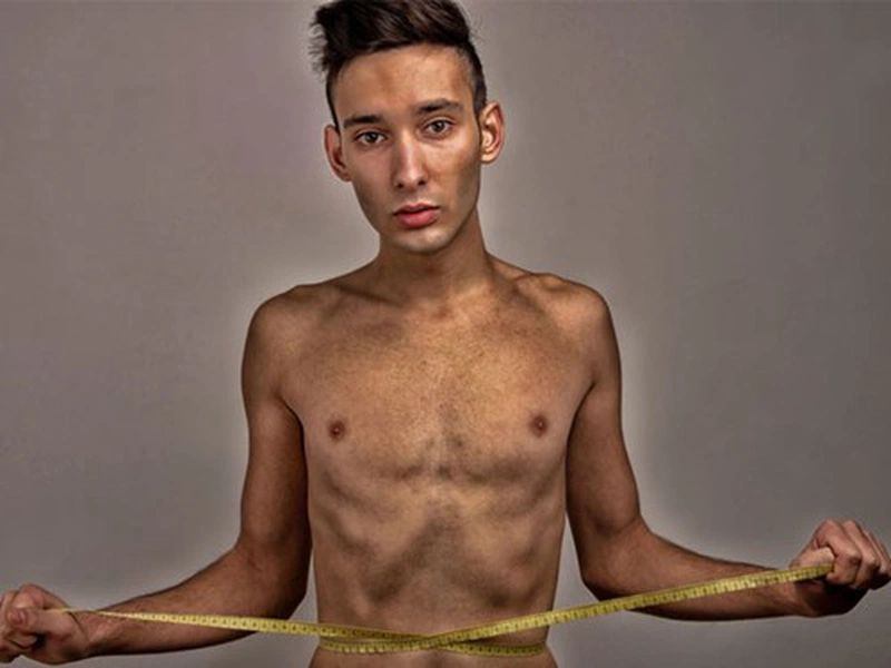 Suy dinh dưỡng là gì?