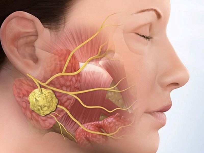 Các yếu tố ảnh hưởng tới thời gian sống của bệnh nhân ung thư xương hàm