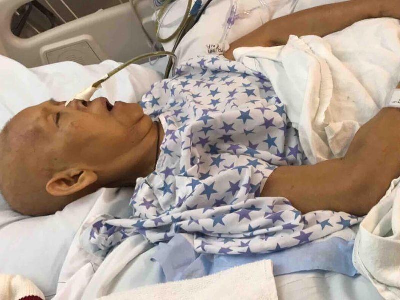 Có nhiều yếu tố ảnh hưởng tới thời gian sống của bệnh nhân ung thư xương