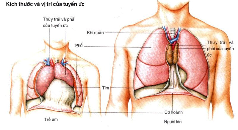 Nguyên nhân gây nên u ác tuyến ức