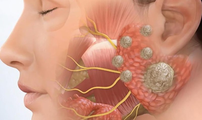 Phương pháp điều trị bệnh