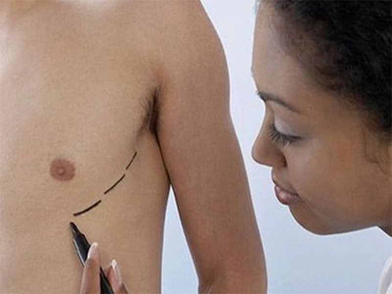 Các phương pháp chẩn đoán ung thư vú