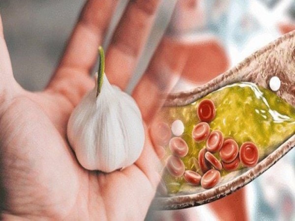 Giảm đường tinh luyện và tinh bột xấu – cứu lá gan và mạch máu