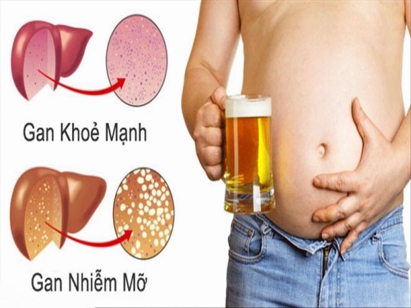 Chọn đúng chất béo – Giảm mỡ xấu, tăng mỡ tốt