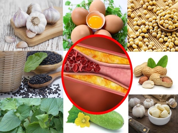 Mỡ máu cao – “sát thủ lặng thầm” từ chiếc đĩa vô thức