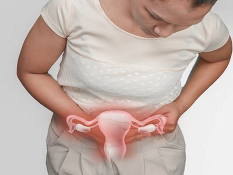 Dấu hiệu ung thư buồng trứng giai đoạn 2