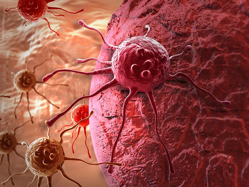  Nguyên nhân bệnh ung thư buồng trứng