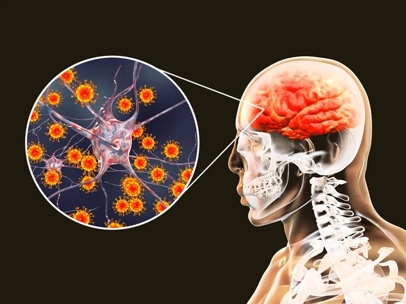 Tiên lượng sống của bệnh nhân mắc ung thư não phụ thuộc nhiều yếu tố