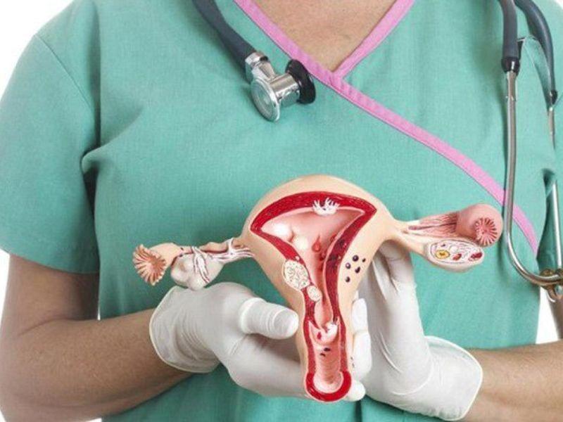 Ung thư buồng trứng giai đoạn 3 có chữa được không?