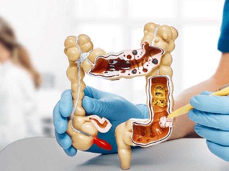 Cách chăm sóc bệnh nhân ung thư đại tràng giai đoạn cuối