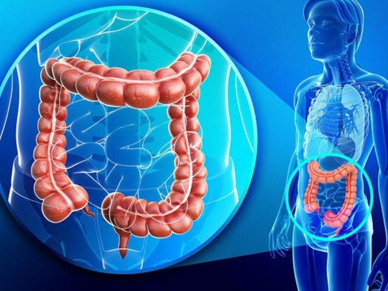 Căn bệnh ung thư đại tràng rất nguy hiểm