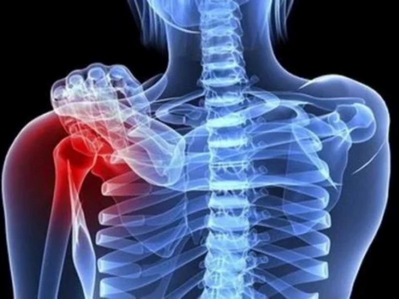 Bệnh nhân mắc ung thư xương sống được bao lâu?