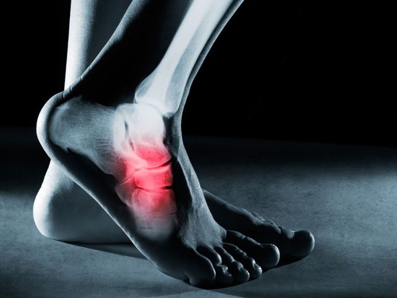 Xét nghiệm ung thư xương gồm những gì? Những điều bạn cần biết