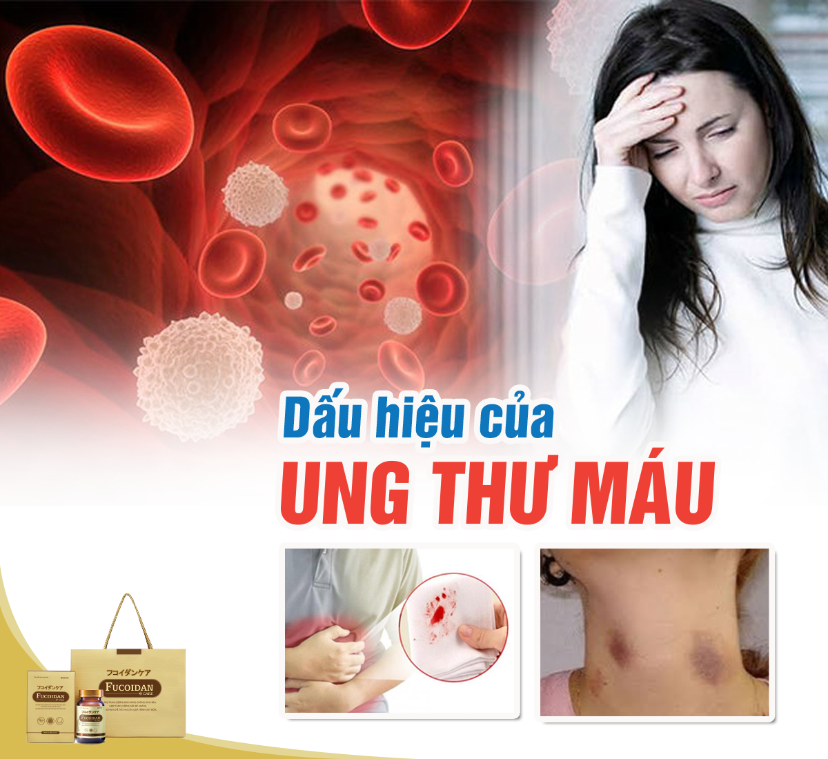 Dấu hiệu của bệnh ung thư máu