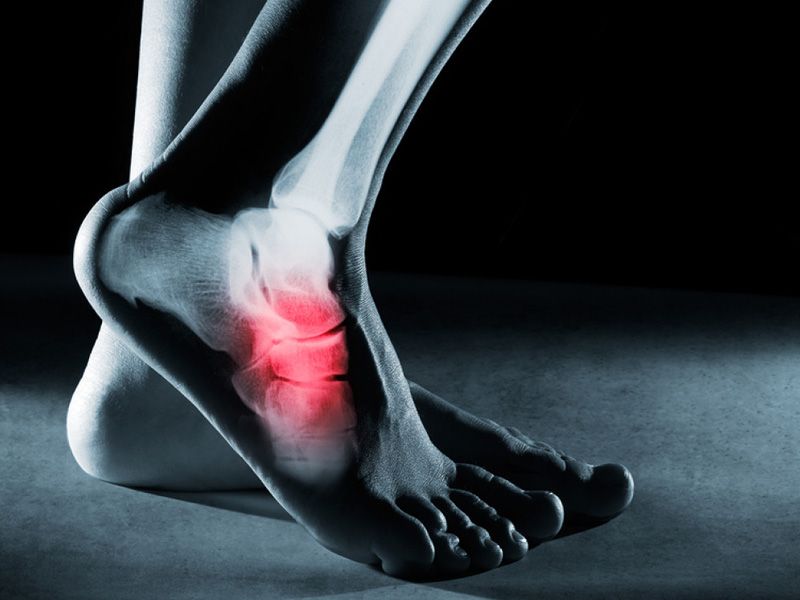 3 dấu hiệu ung thư xương giai đoạn đầu