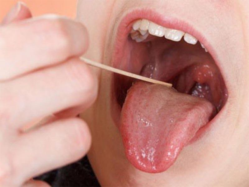 Các bước tự kiểm tra ung thư vòm họng chi tiết tại nhà