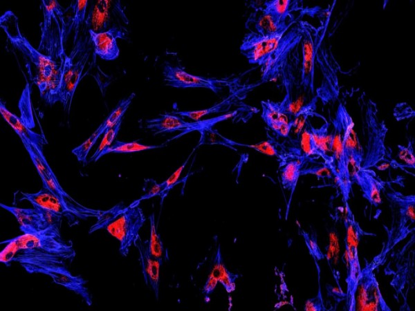 Miễn dịch huỳnh quang chìa khóa soi sáng cơ chế miễn dịch