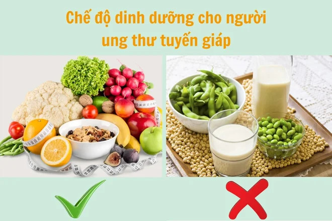 Nguyên tắc dinh dưỡng cho bệnh nhân ung thư tuyến giáp