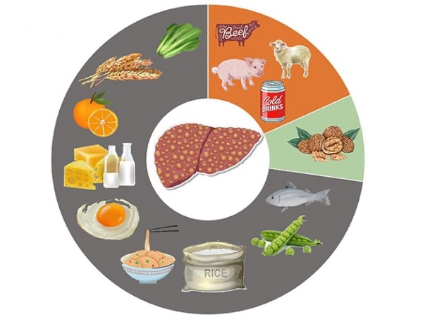 Gan nhiễm mỡ: Ăn thế nào đúng cách và giảm bệnh nhanh