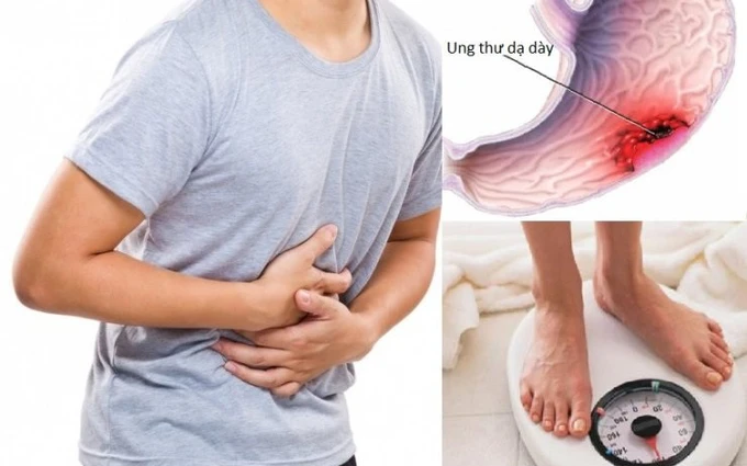 Tìm hiểu căn bệnh ung thư dạ dày di căn sống được bao lâu?