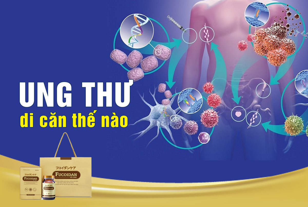 Ung thư di căn là gì và ung thư di căn có chữa được không?