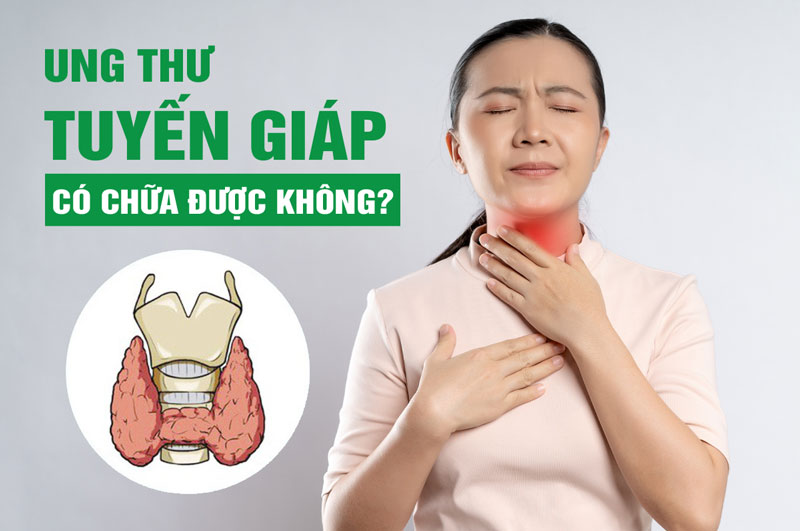 Ung thư tuyến giáp có chữa được không?